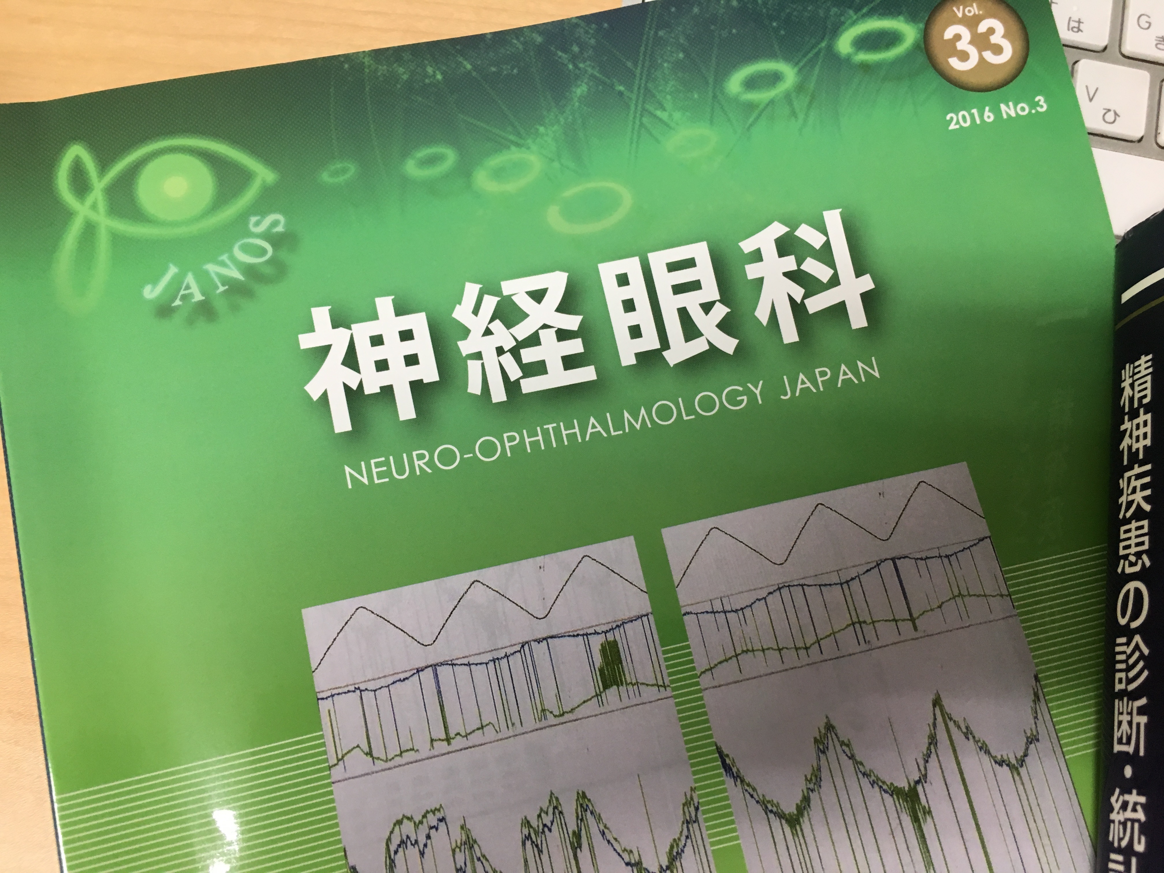 発達障害と眼 | 柳津あおやま眼科クリニック
