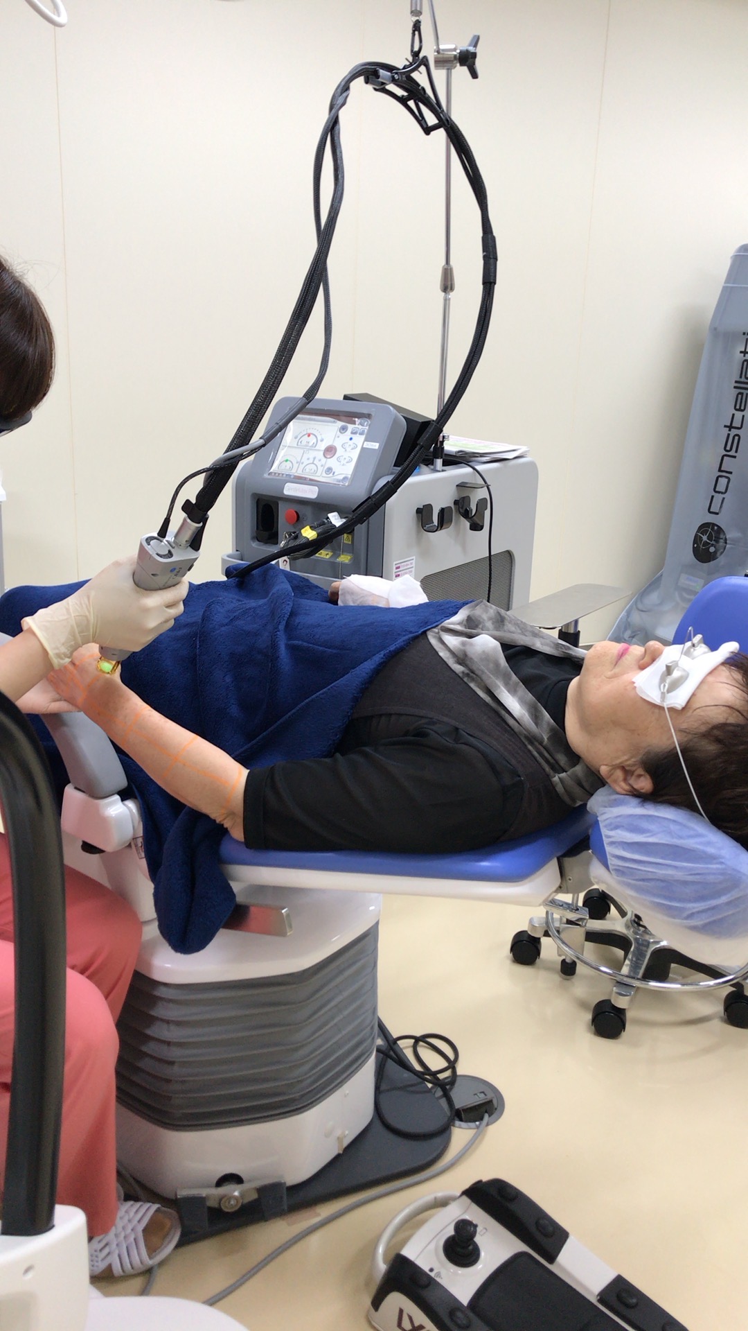 シミ取りレーザー治療 | 柳津あおやま眼科クリニック