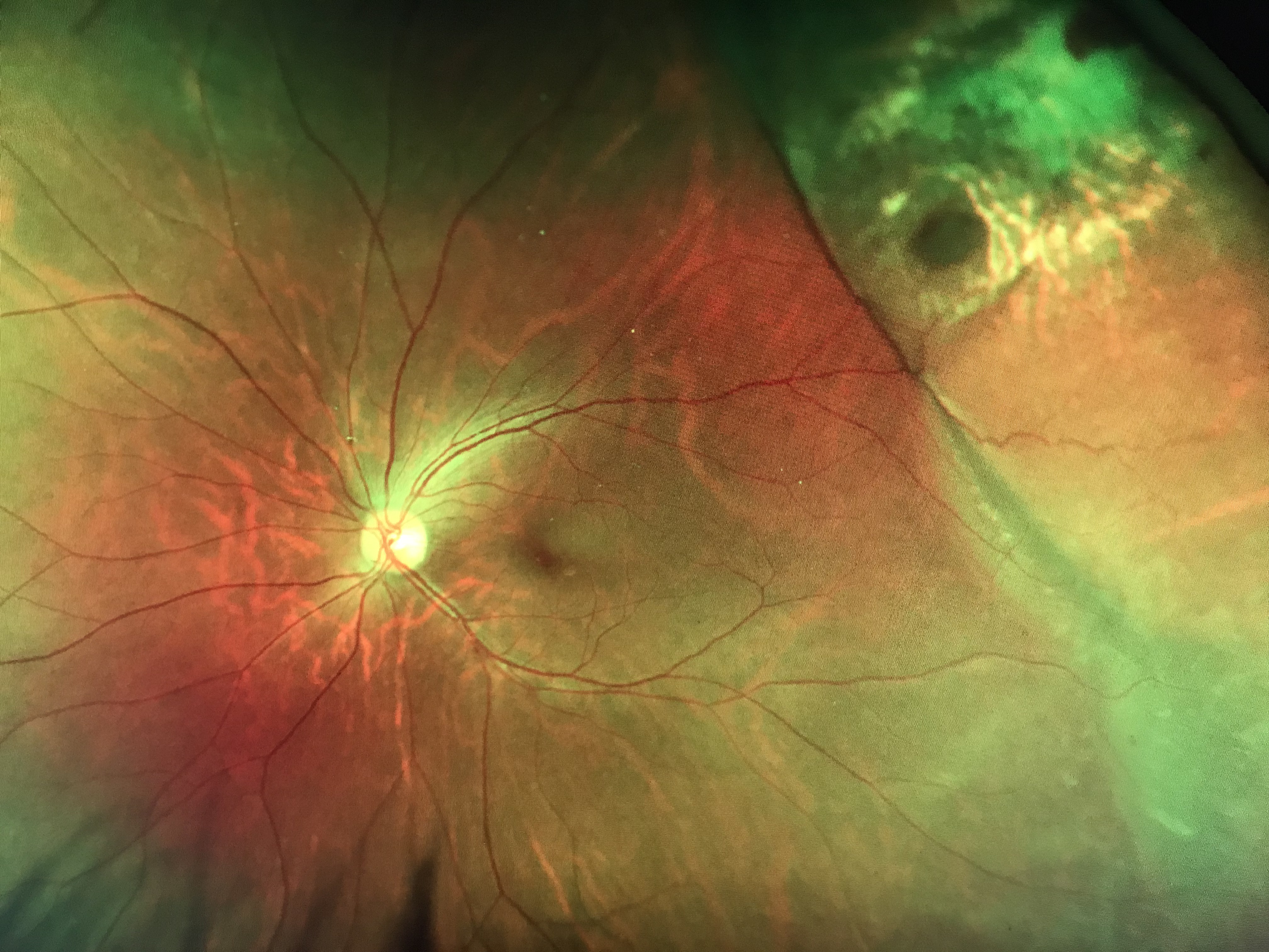 IMG_9381.jpg