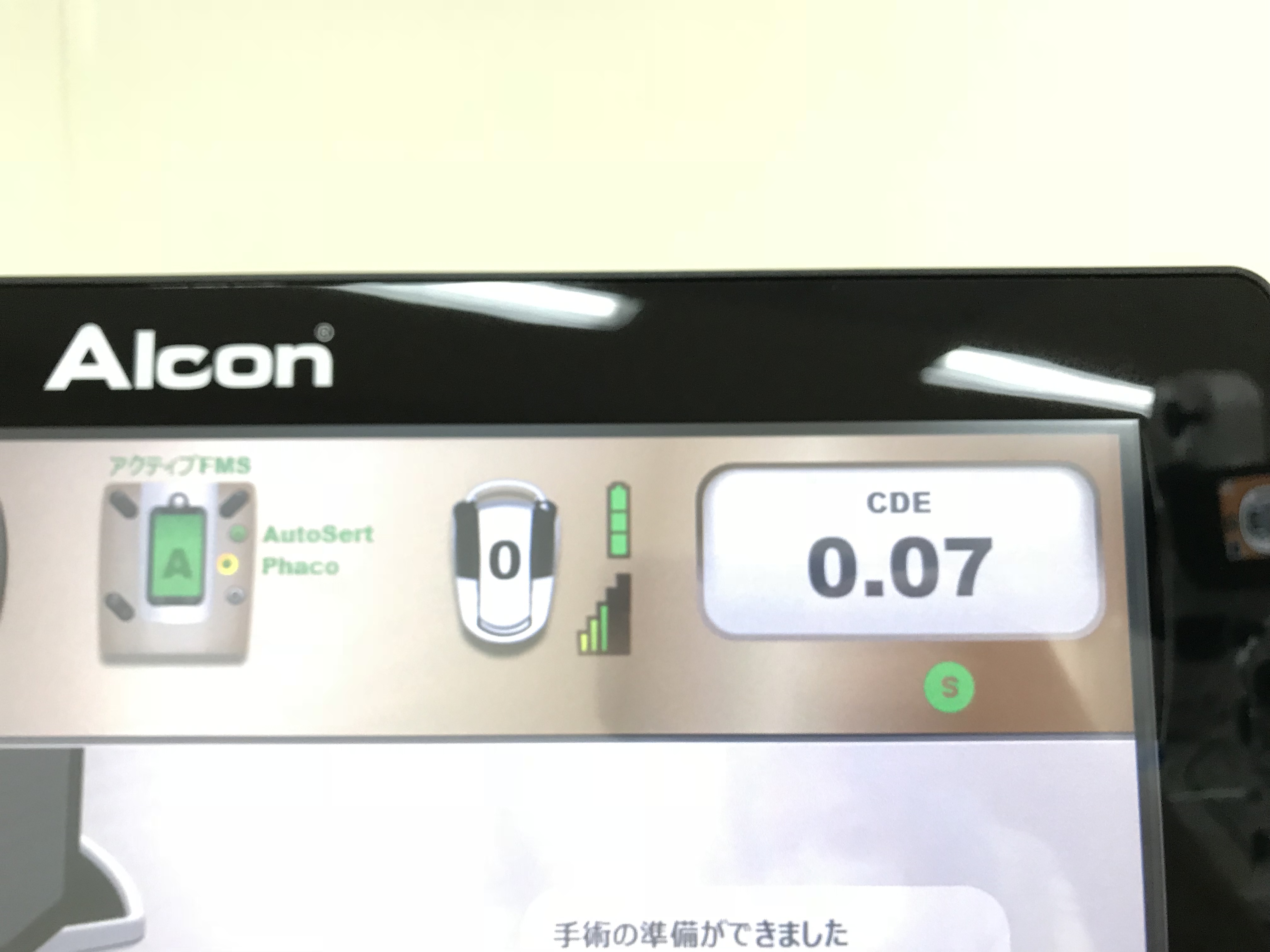 ゼロフェイコ | 柳津あおやま眼科クリニック