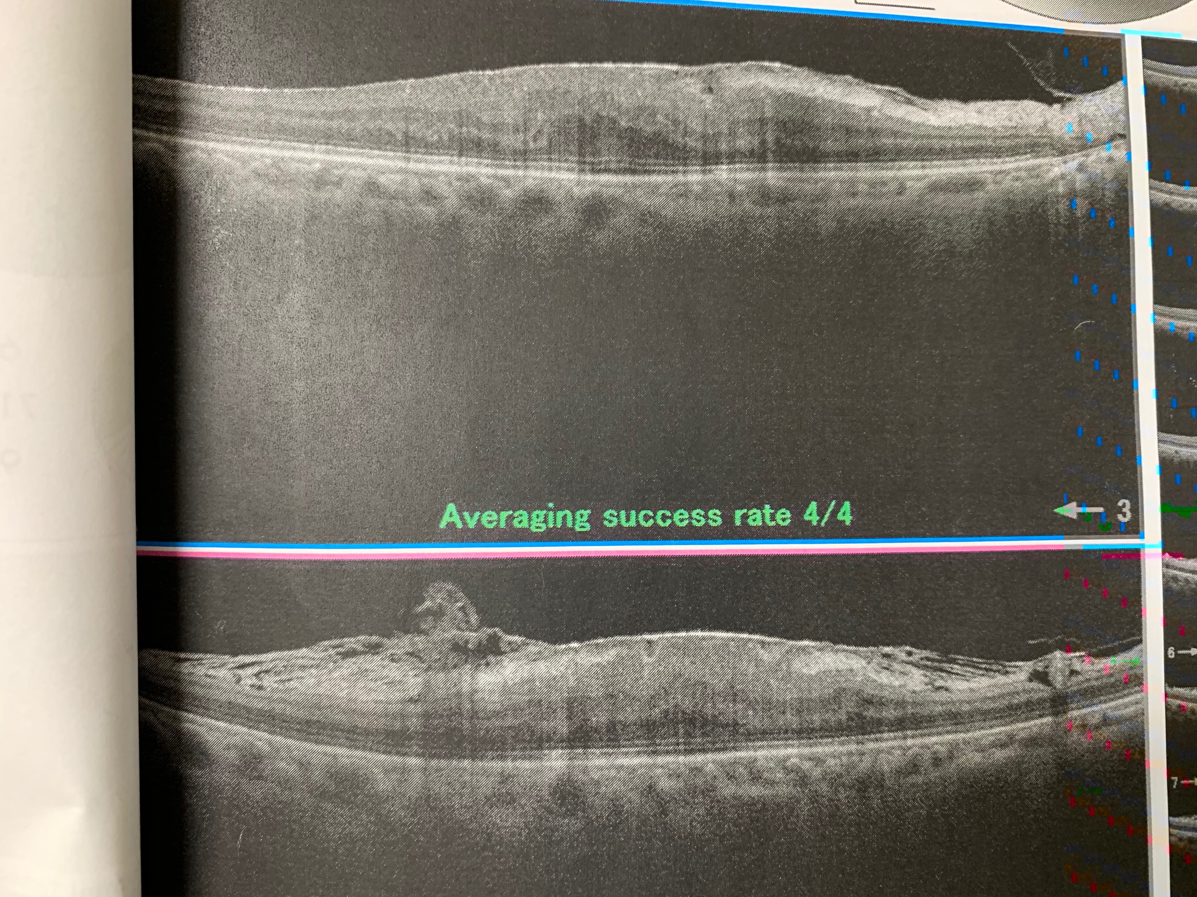 光膜理論 ハイパースペクトルカメラで、膜厚の絶対値を測定することは可能ですか