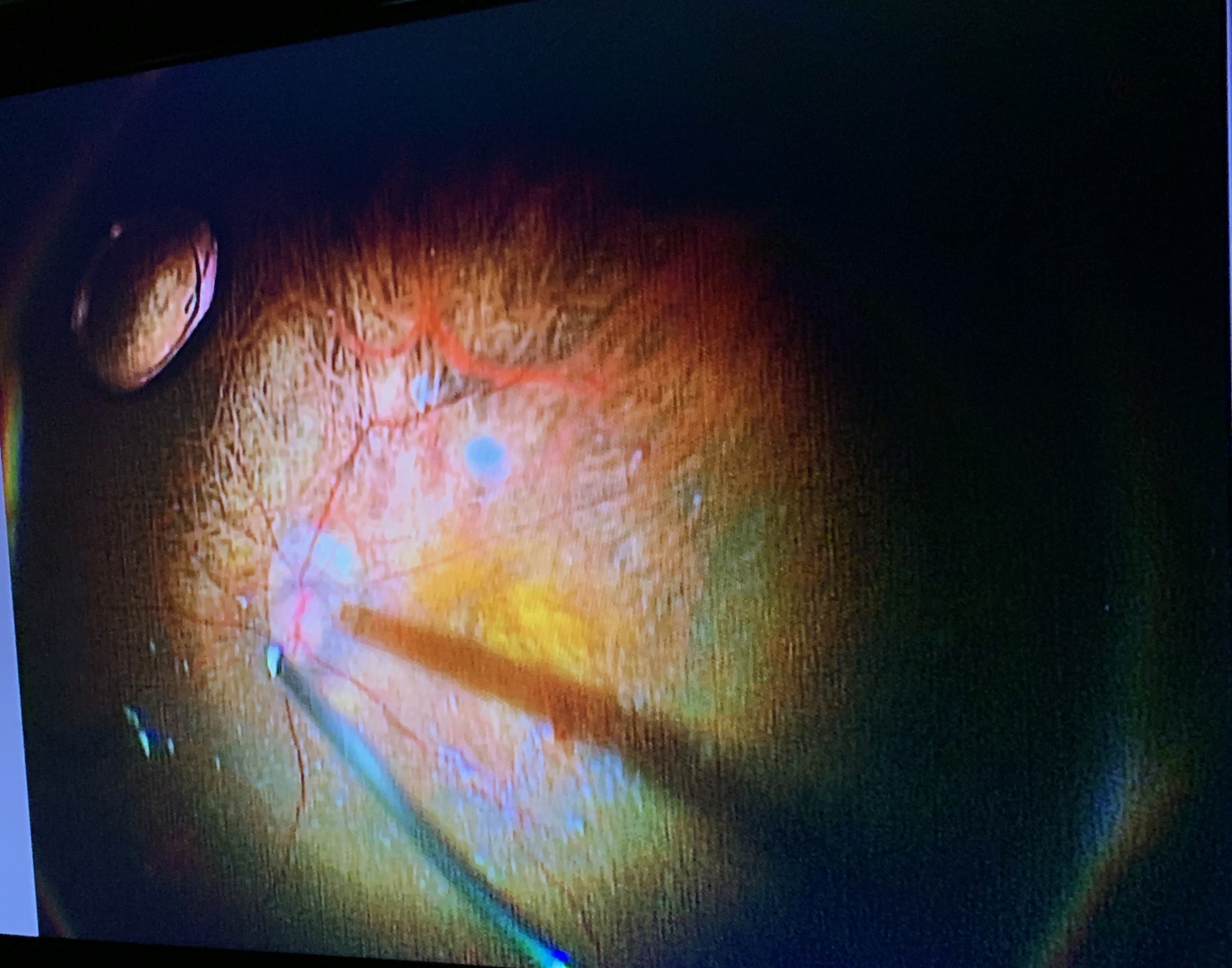 6月 | 柳津あおやま眼科クリニック