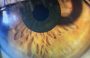 角膜内インレー眼の硝子体手術